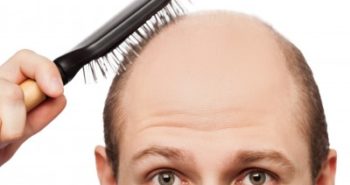 טופיק – פתרון עיבוי לסיבי שיער